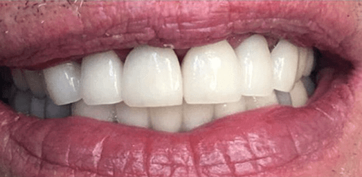 Smile Image