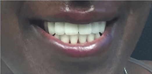 Smile Image