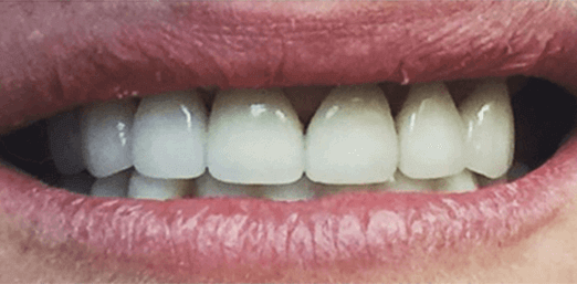 Smile Image