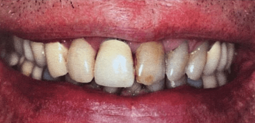 Smile Image
