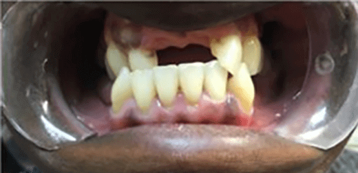 Smile Image