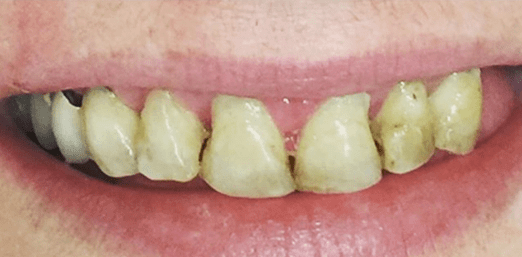 Smile Image